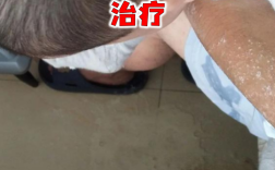 宝宝吃土豆泥后吐，是过敏还是消化不良？