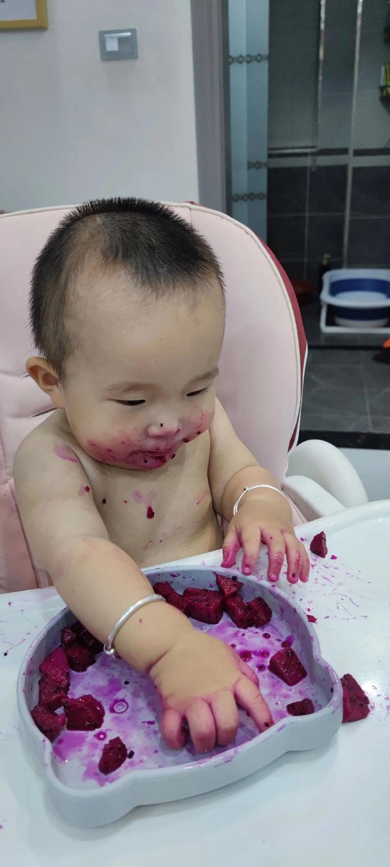 宝宝吃火龙果起疙瘩是过敏吗？-图2