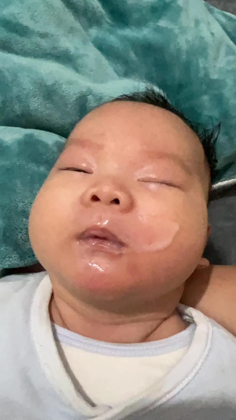 宝宝吃猪油馍呕吐是过敏还是不消化?-图3 宝宝吃猪油馍呕吐是过敏还是不消化?-图3