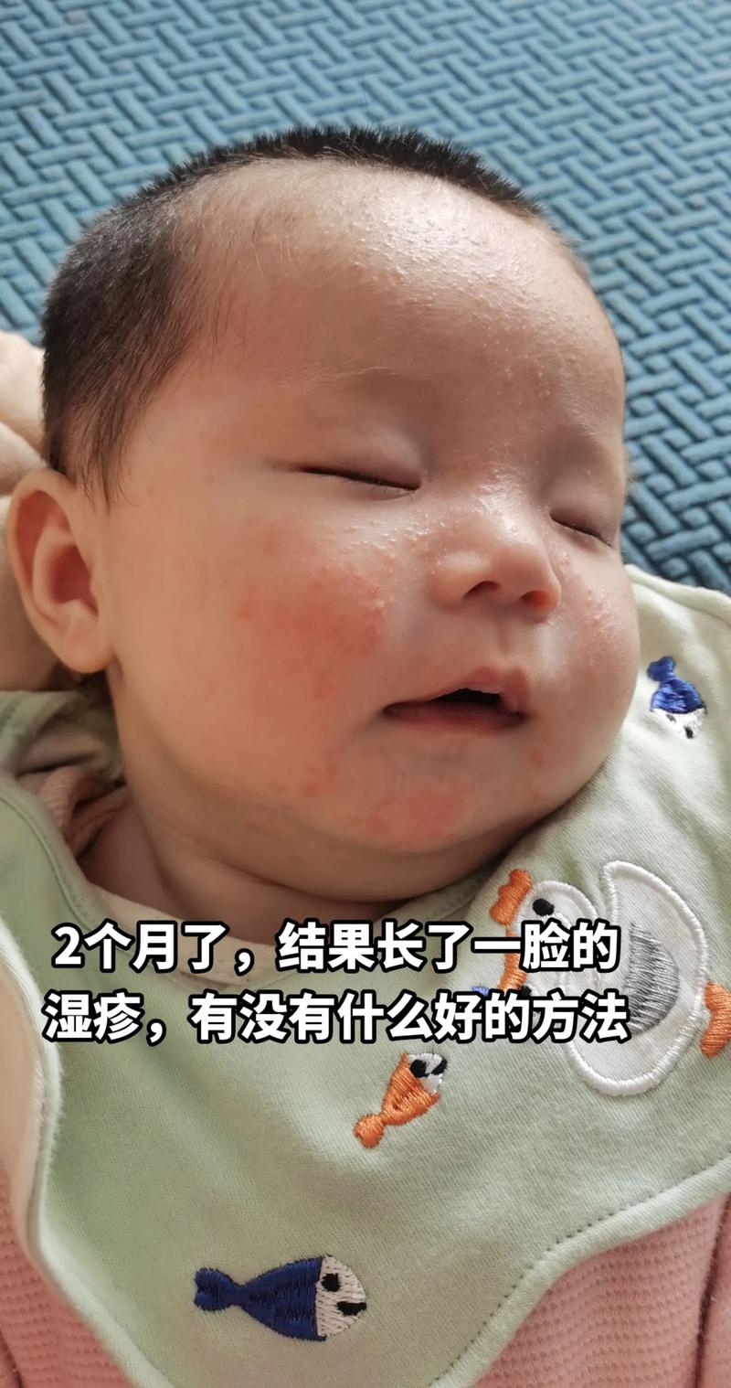 海鲜丸子吃后脸颊发红是过敏吗？-图1