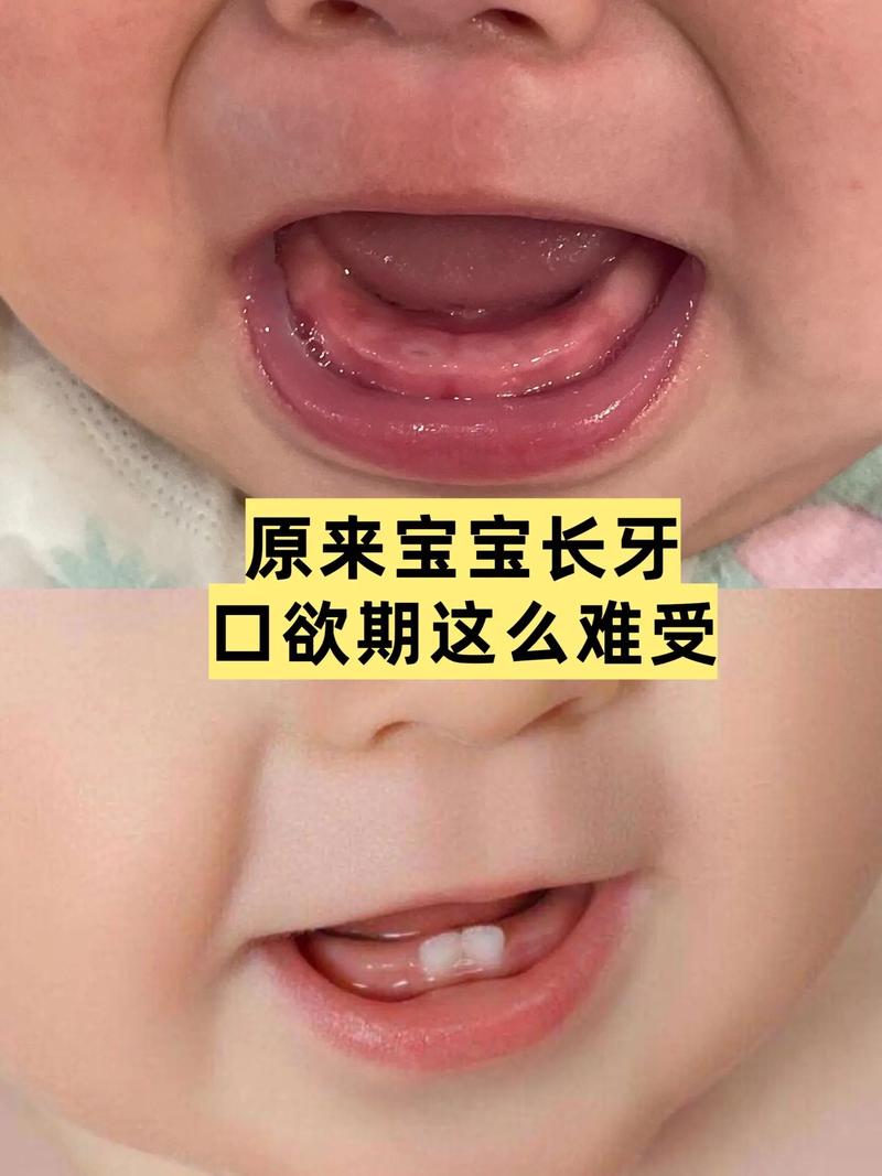 八个月宝宝吃磨牙饼干合适吗?-图2 八个月宝宝吃磨牙饼干合适吗?-图2