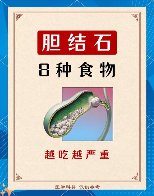 胆结石患者适合吃哪些家常菜?-图1 胆结石患者适合吃哪些家常菜?-图1