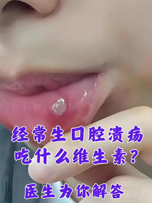 宝宝口腔溃疡，吃什么能好得快？-图3