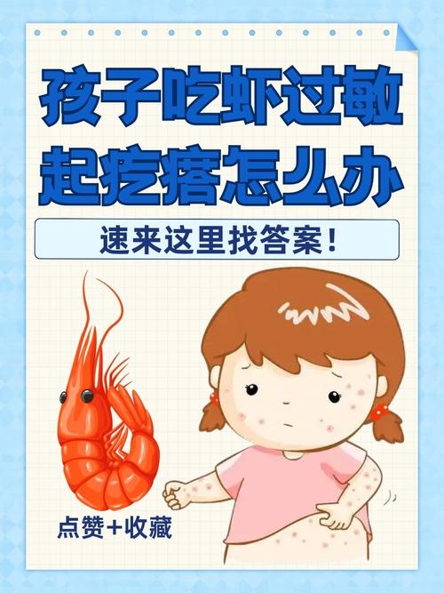 小儿海鲜过敏了该怎么办？-图1