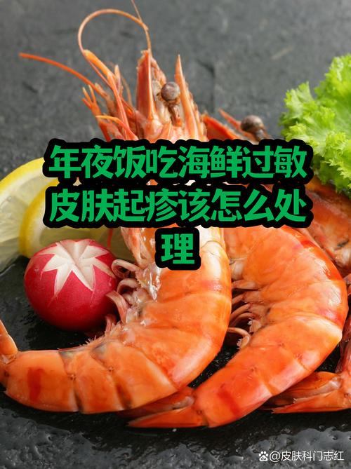 海鲜过敏后喝牛奶会加重吗？-图3